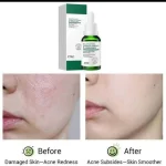 سرم پوست سالیسیلیک اسید مدل ای تای ETAE(وزه سابق) Veze  حجم 30 میلی لیتر - Image 2