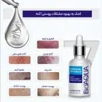 سرم ضد جوش بیو آکوا مدل ترمیم کننده حجم 30 میلی لیتر - Image 3