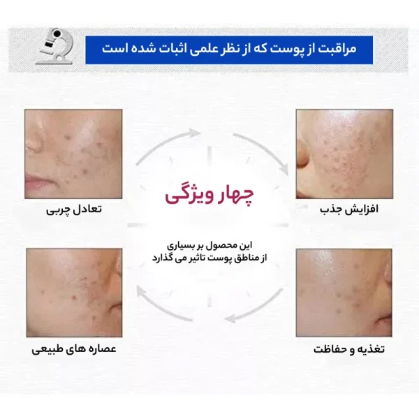 کرم ضد جوش بیو آکوا مدل اضطراری وزن 30 گرم - Image 4
