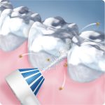 دهانشویه اوکسی جت اورال بی مدل AQUA CARE 4 - Image 4
