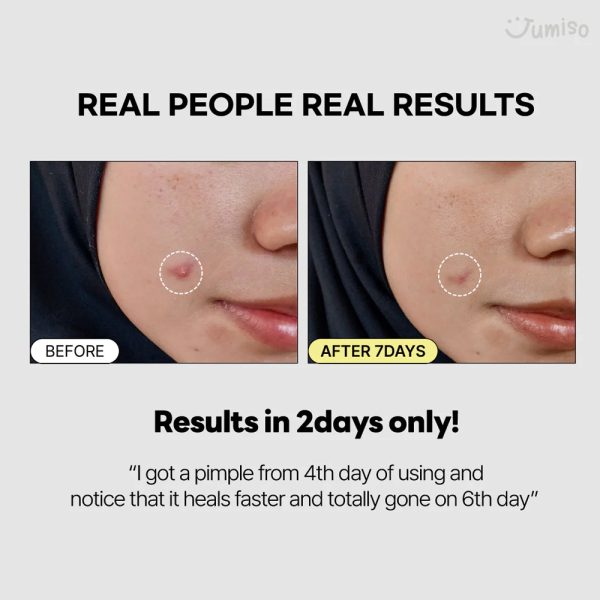 اسنس آبرسان حلزون + پپتاید جومیسو حجم 140 میلی لیتر - Image 7