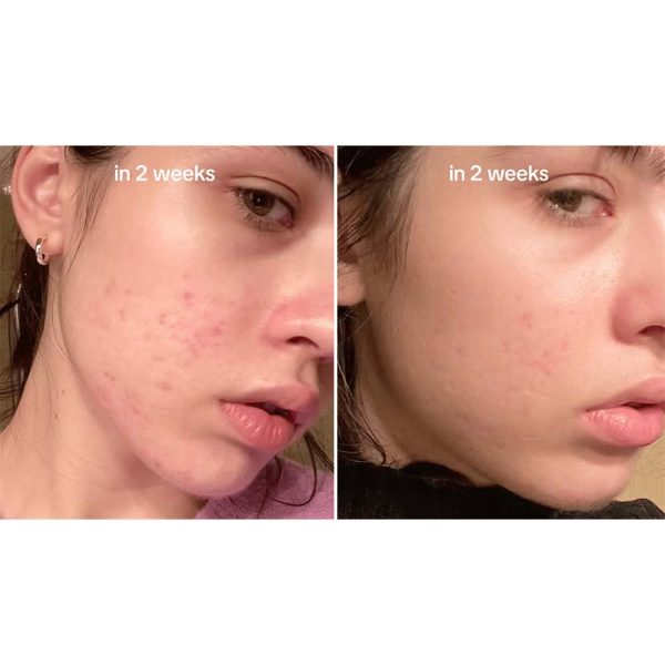 سرم ضد لک آنوا مدل نیاسینامید 10% + ترانگزامیک اسید 4% حجم 30 میلی لیتر - Image 4