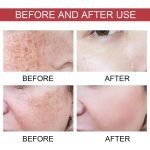 سرم ضد لک آنوا مدل نیاسینامید 10% + ترانگزامیک اسید 4% حجم 30 میلی لیتر - Image 5