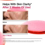 سرم ضد لک آنوا مدل نیاسینامید 10% + ترانگزامیک اسید 4% حجم 30 میلی لیتر - Image 11