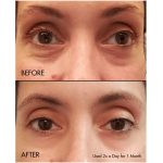 کرم دور چشم کلینیک مدل All About Eyes - Image 7
