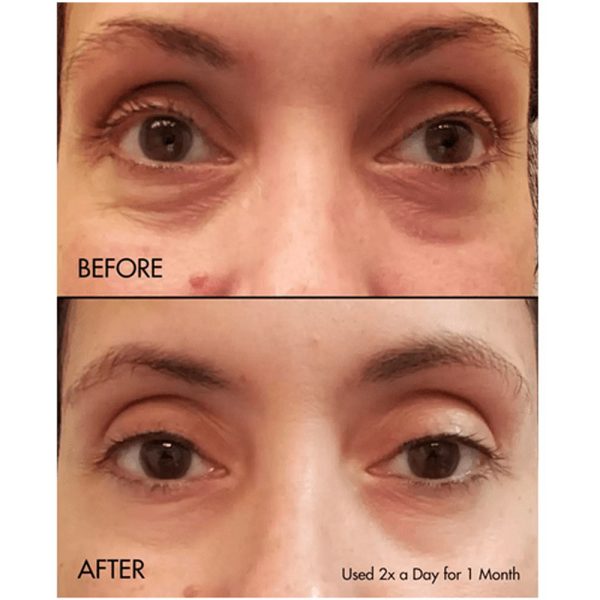 کرم دور چشم کلینیک مدل All About Eyes - Image 7